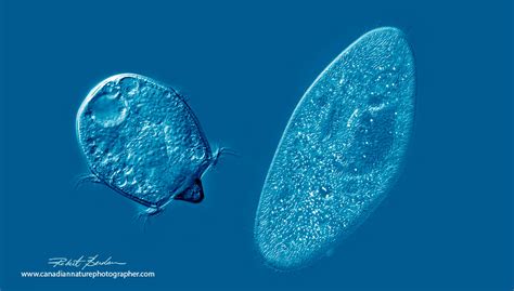 Didinium: Dieses winzige Räubertier mit Cilien-Plättchen schleicht sich durch das Wasser und frisst andere Ciliaten!