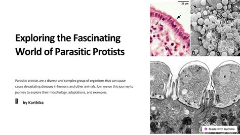  Ribotrema! Erkundet die faszinierende Welt dieser parasitischen Wunderwesen mit komplexen Lebenszyklen