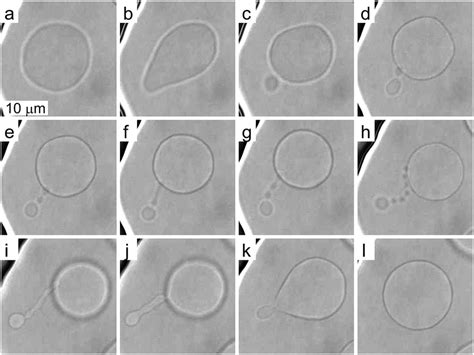  Ulomoides Derivat: Ein Meister des Versteckspiels mit Fadenartigen Auswüchsen!